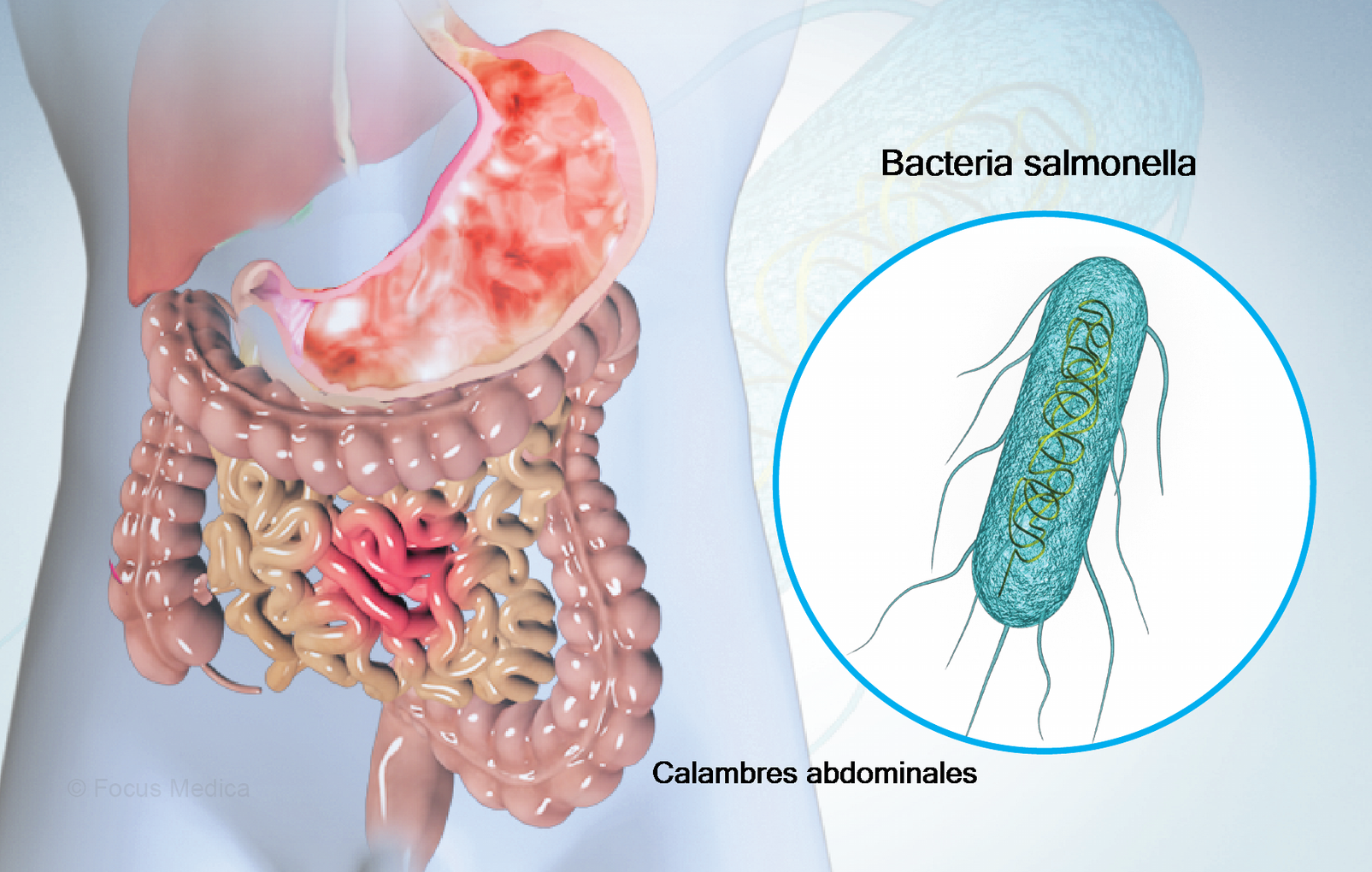 sintomas de salmonella